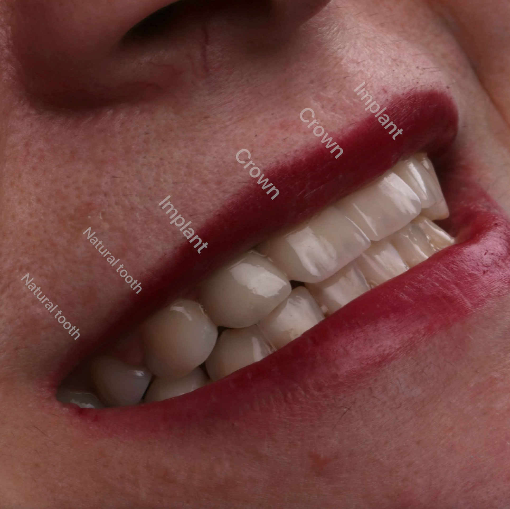 treatment images1