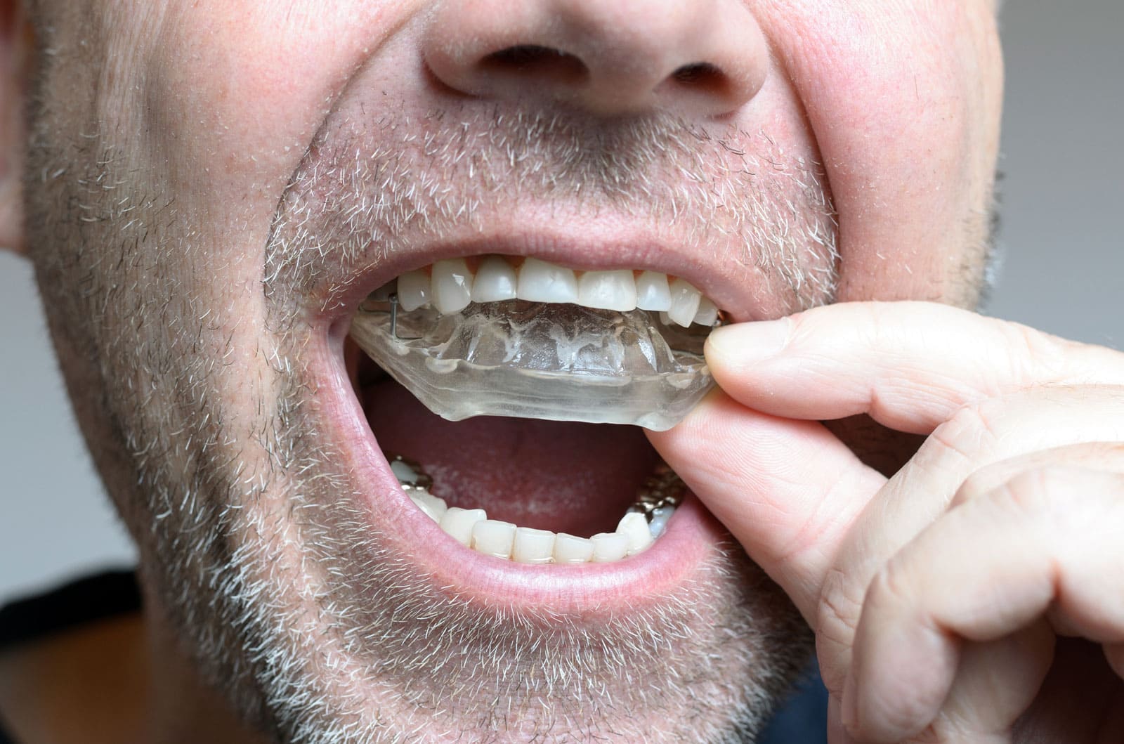 Jaw Joint Diseases Treatment in Turkey