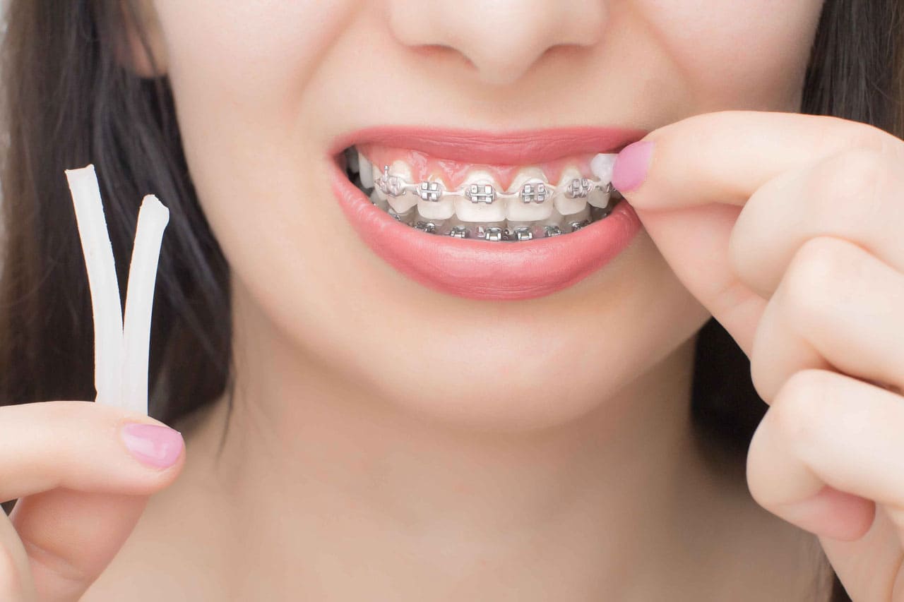 Orthodontic Treatment in Turkey