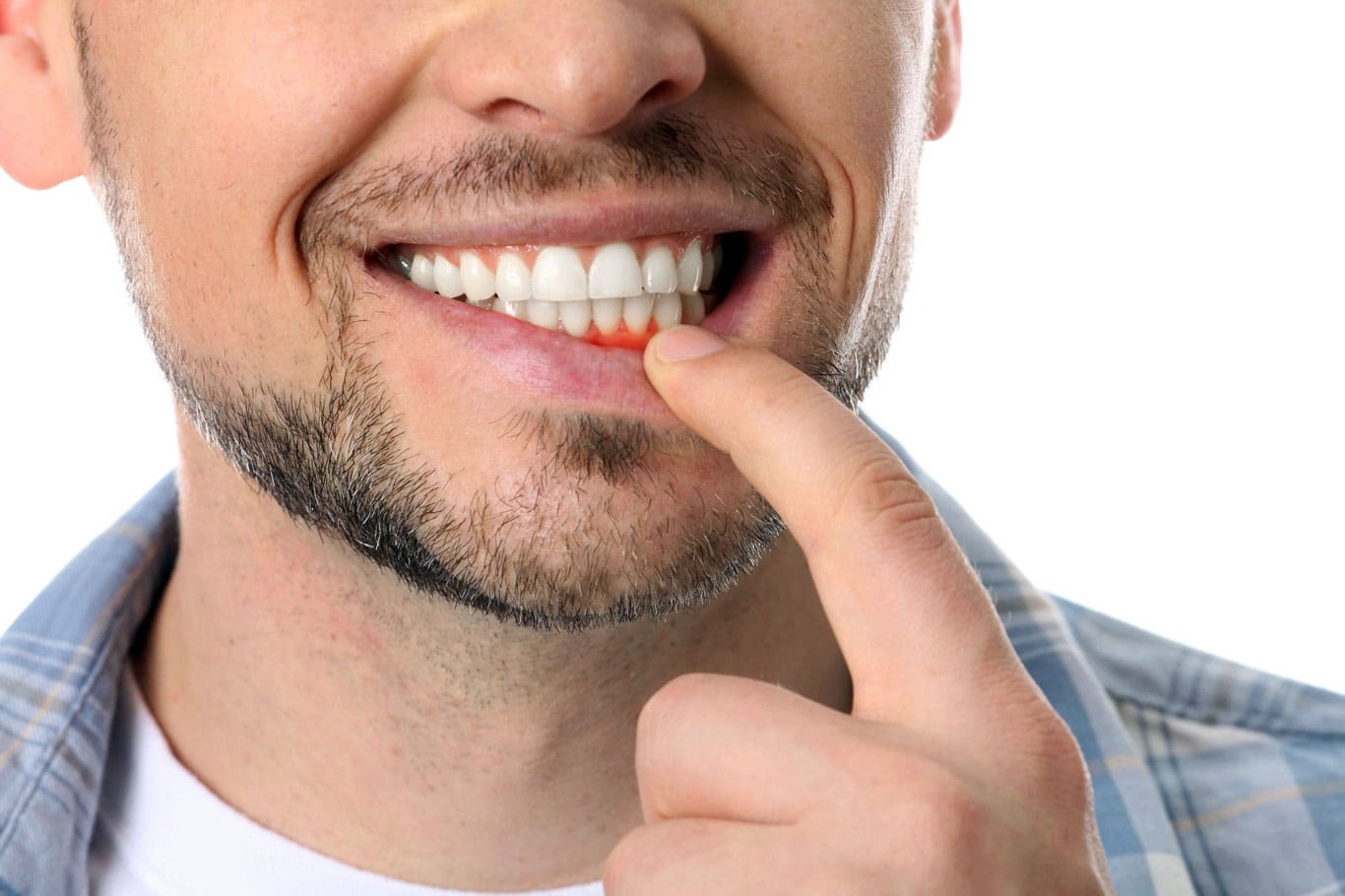 What are surgical gum recession treatments in Turkey