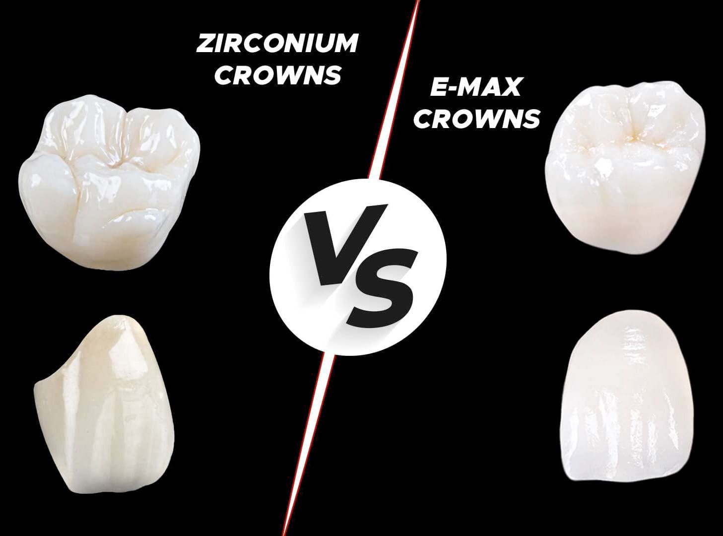 Is E.MAX better than Zirconia?