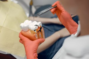 Teeth Decay