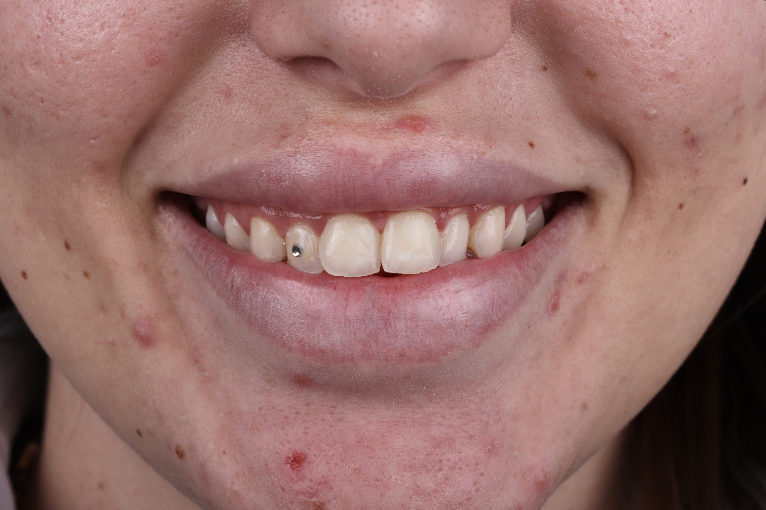 ekiz clinic before-after